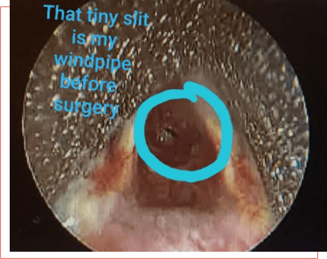 A picture of the inside of an eye with text.