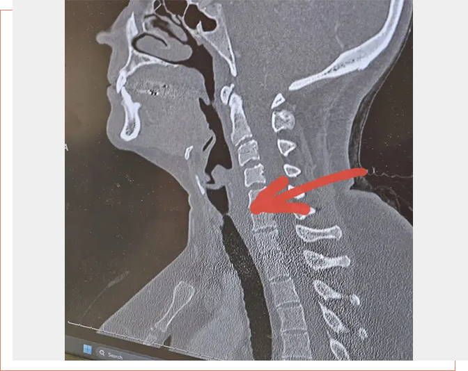 A picture of the back end of a neck.